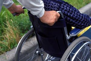 痛みが少ない刺青除去できる大阪